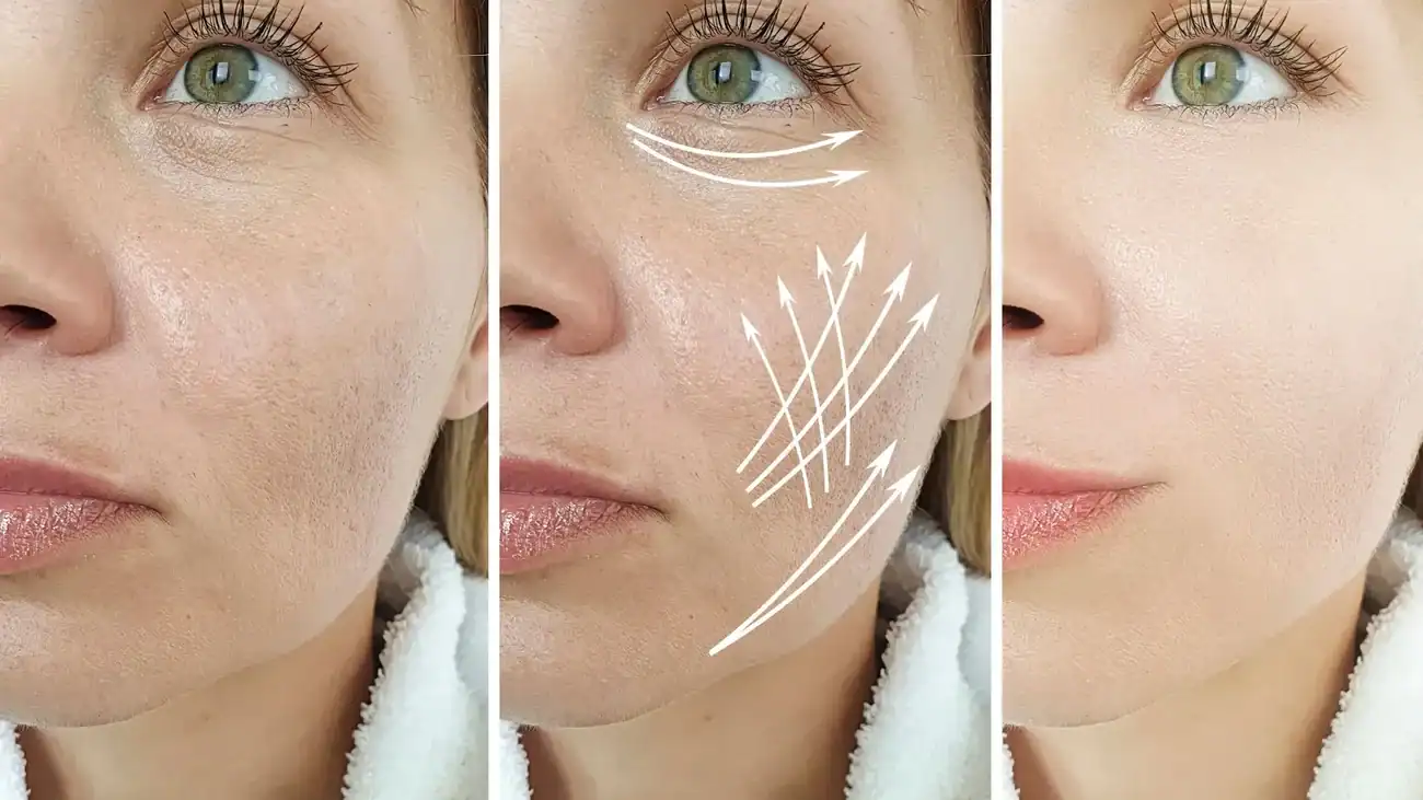 Can One Treatment Really Tackle More Than One Skin Concern Higham Ferrers?