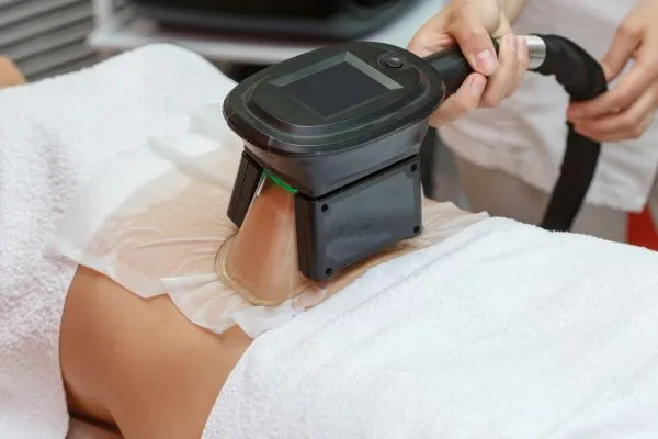 Image of person having fat freezing treatment to help weight gain Higham Ferrers