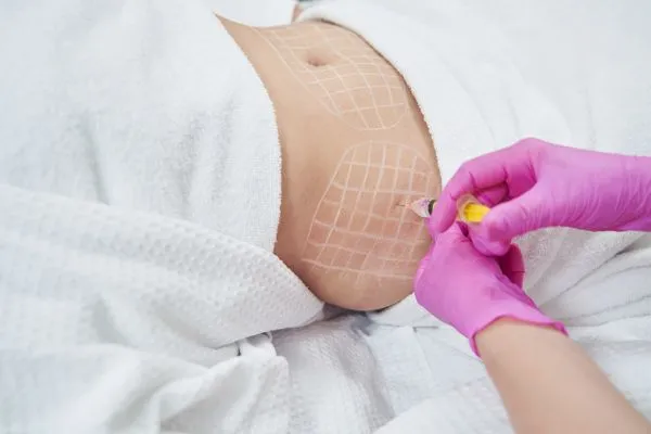 image of fat dissolving injections on love handles to help combat weight gain Higham Ferrers