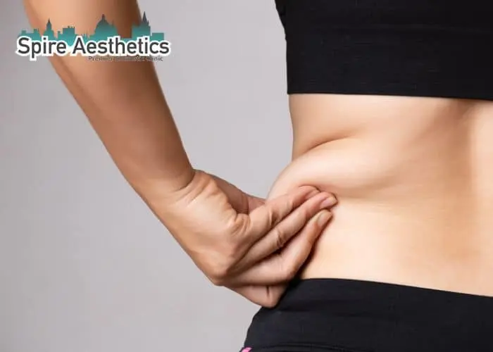 Image of woman pinching fat on their hips Higham Ferrers. Fat Freezing treatment