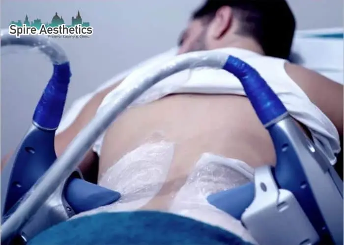 Man having fat freezing treatment done on love handles before a competitions Higham Ferrers to create a sculpted look.