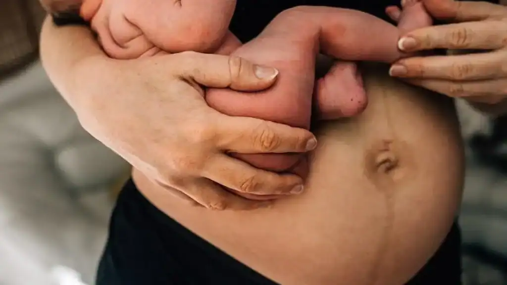Why Is My Stomach Still Big After Pregnancy Higham Ferrers?