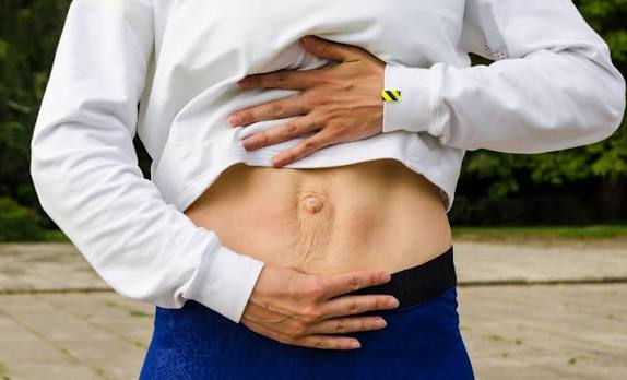 When Could Diastasis Recti Be the Missing Piece of the Puzzle Higham Ferrers?